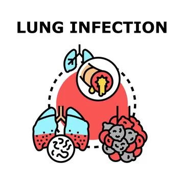 Lung infection disease concept vector illustration 스톡 일러스트