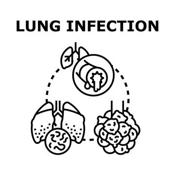 Lung infection disease concept vector illustration Stock Illustration