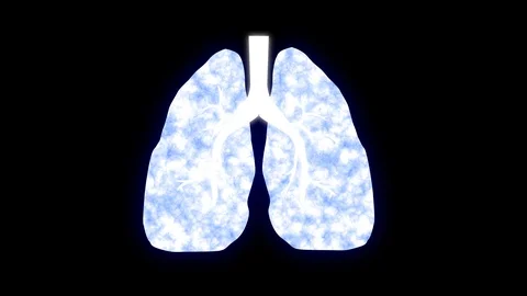 Lung infection Stock Footage 127217183