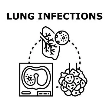 Lung infections causing respiratory disease and illness 스톡 일러스트