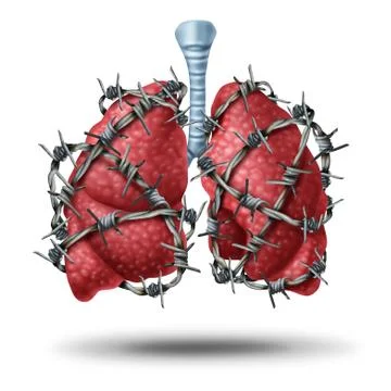 Lung Pain Illustrazione stock