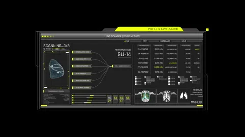Lung Scanner Medical HUD Sci-Fi UI Diagnostic Interface 動画素材 338389998