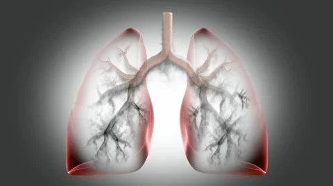 Lung Smoke Stock Footage 49748521