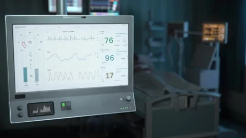 Lung ventilation machine keeping the patient alive at the healthcare clinic Video stock 256600089
