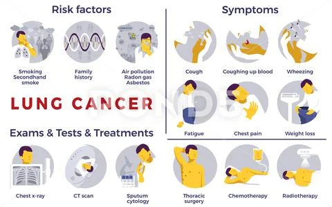 LungCancerSet Ilustraciones de archivo
