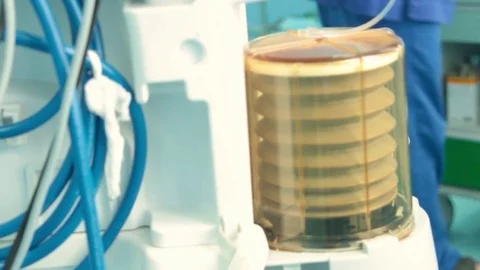 Lungmotor is connected to the patient 스톡 동영상 70003318