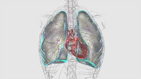 Lungs affected by miliary tuberculosis, animation Stock Footage 295181857