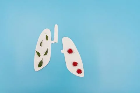 Lungs affected by virus Foto stock