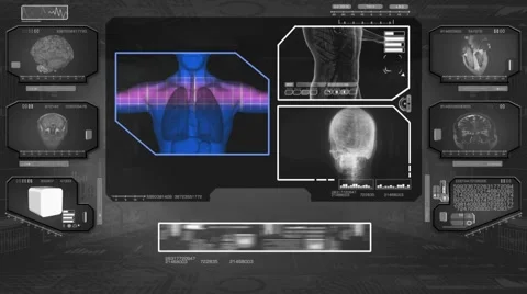 Lungs Analysis  - High Tech Scan - Black 01 Stock Footage 58506255