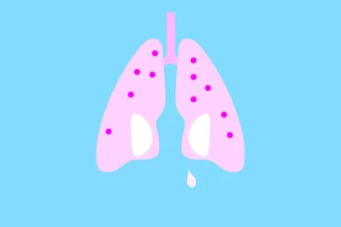 Lungs and virus flat design illustration イラスト素材