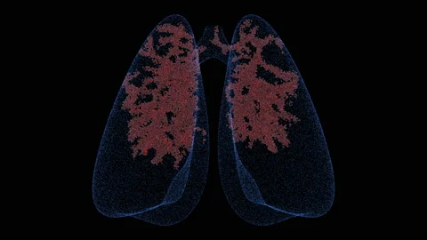 Lungs with animated virus. Stock Footage 128394659