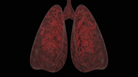 Lungs with animated virus. Vídeos de archivo 128394811