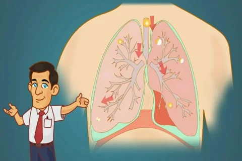 Lungs - Blue Background - professor Stock Footage 68613785