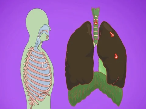 Lungs breathing Vector Animation purple SD Stock Footage