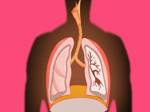 Lungs   Flashes   Vector Animation   pink   SD Stock Footage 73227490