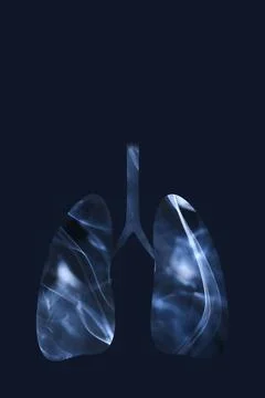 Lungs full of smoke. Concepts of World No Tobacco Day and smoking cessation Stock Illustration