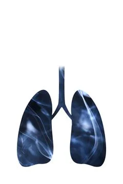Lungs full of smoke. Concepts of World No Tobacco Day and smoking cessation Stock Illustration