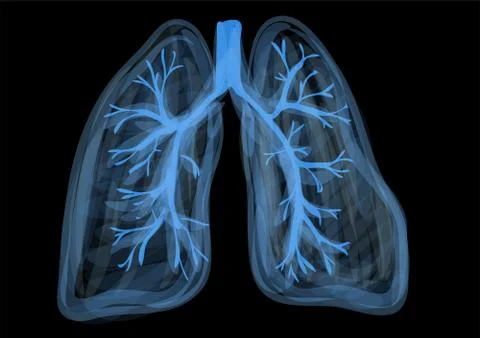 Lungs Stock Illustration
