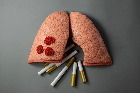 Lungs Stock Photos