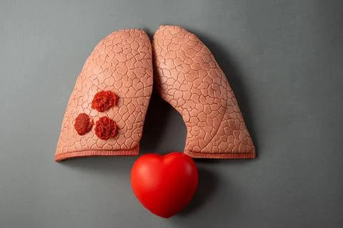 Lungs Stock Photos
