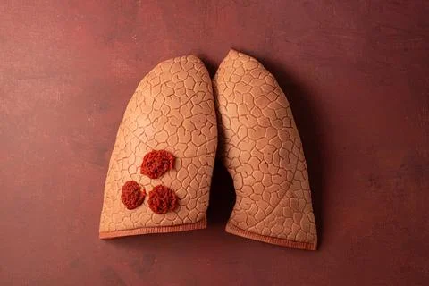 Lungs Stock Photos