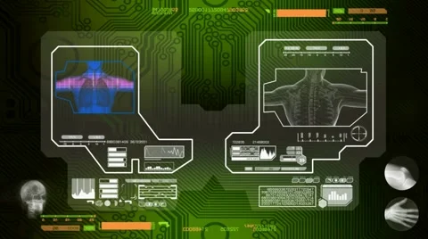 Lungs - Scanned by Software - green 00 Stock Footage 58553993