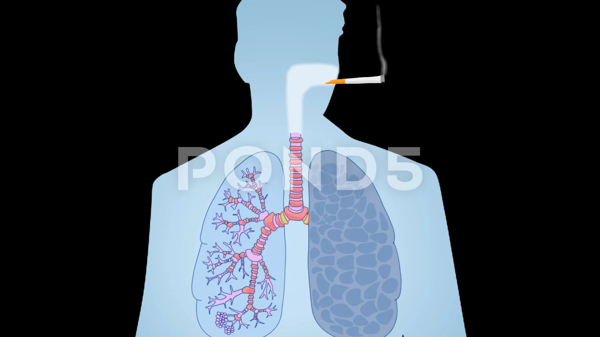 Lungs Smoking Vector Animation bla... | Stock Video | Pond5