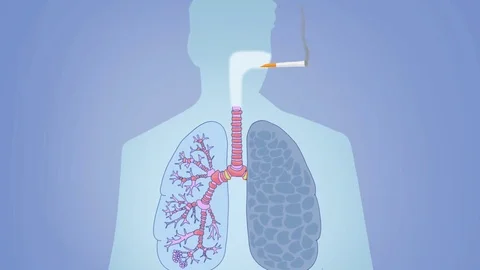 Lungs Smoking Vector Animation blue Stock Footage