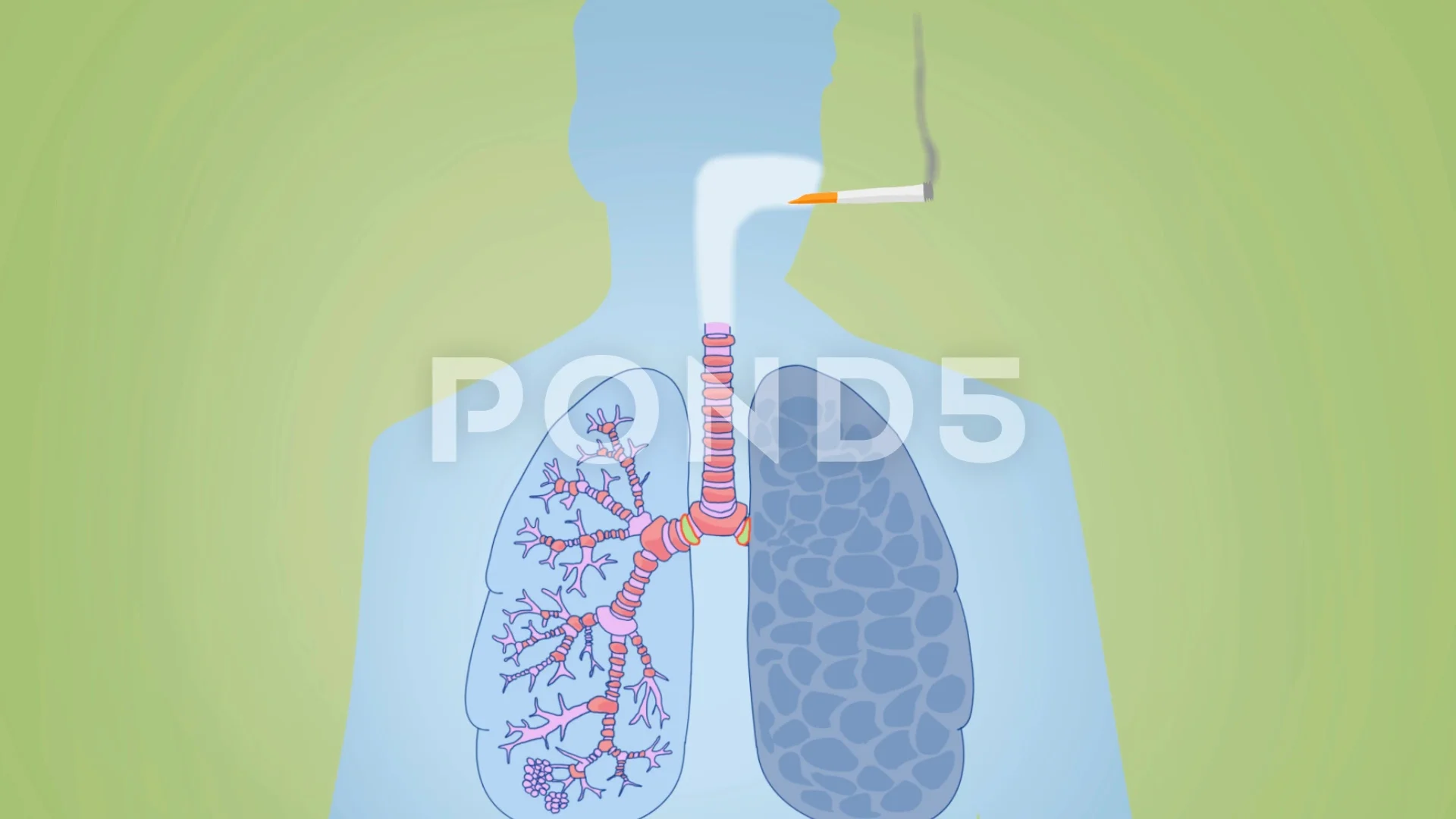 Lungs Smoking Vector Animation gre... | Stock Video | Pond5
