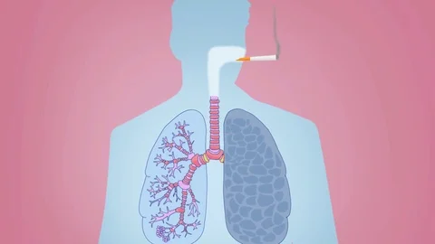 Lungs Smoking Vector Animation pink Stock Footage