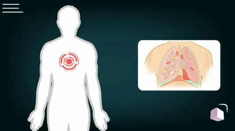 Lungs - vector animation - analysis - blue Stock Footage 60398104
