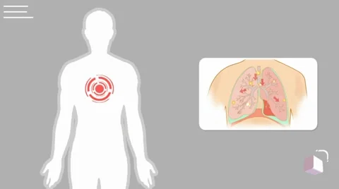 Lungs - vector animation - analysis - white Video stock 60398125