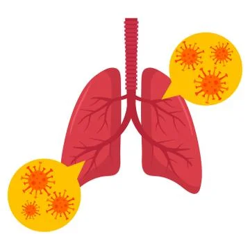 Lungs with virus. Vector illustration. Flat design. Stock Illustration