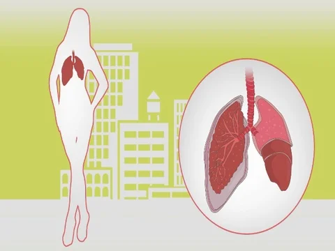 Lungs Woman Vector Animation Yellow SD Stock Footage