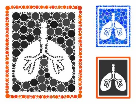 Lungs x-ray photo Composition Icon of Circles Stock Illustration