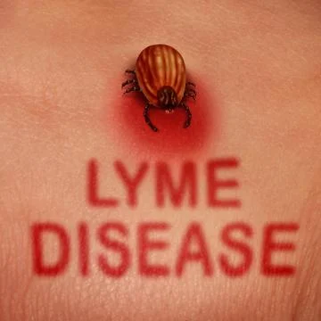 Lyme Disease Concept Stock Illustration