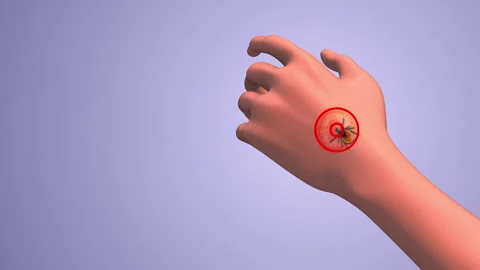 Lyme hand red cells animation Stock Footage 270056962