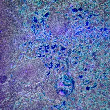 Lymph gland tissue 스톡 사진