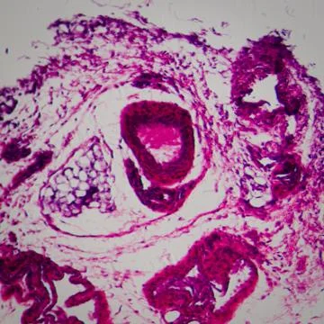 Lymph gland tissue 스톡 사진