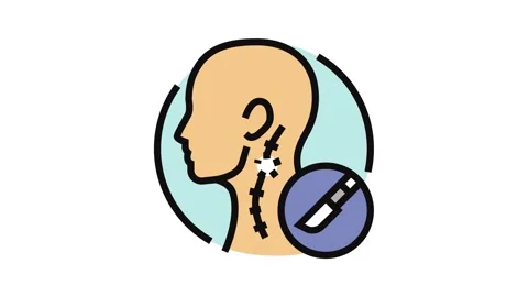 Lymph node dissection surgery color icon animation Video stock 326102767