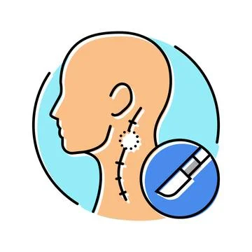 Lymph node dissection surgery color icon vector illustration Illustrazione stock