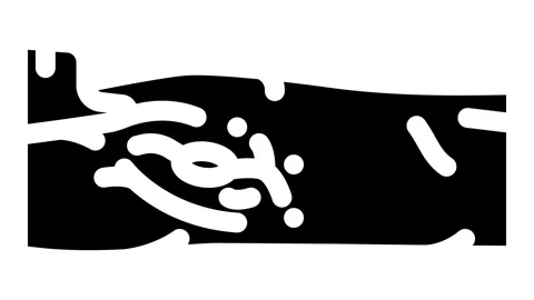 Lymph node dissection surgery glyph icon animation Stock Footage 326738084