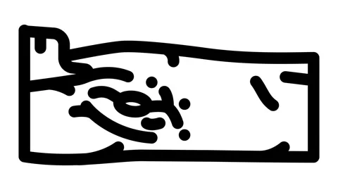 Lymph node dissection surgery line icon animation Stock Footage 326753777