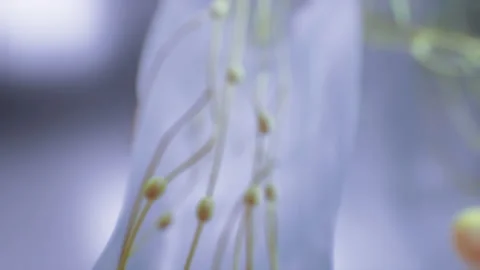 Lymph Node Networks in Human Body 2 Vidéo 130206500