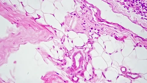 Lymph node in section magnified under microscope in 400x times on bright field Видео 222560073