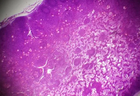 Lymph node section under the microscope Stock Photos