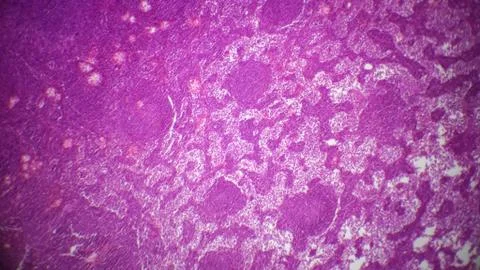 Lymph node section under the microscope Stock Photos