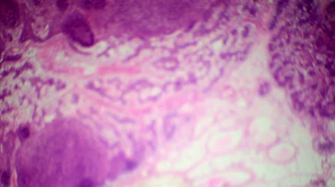 Lymph node slice under the microscope (Lymph node C.S.), Full HD Stock Footage 47111812