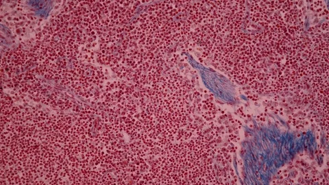 Lymph node tissue under the microscope Stock Footage 343957677