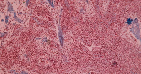 Lymph nodes in cross section Stock Footage 144612422